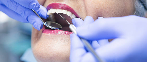 Best Emergency Dental Care for Broken or Chipped Teeth in Black Forest, CO